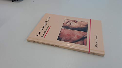 Stock image for Contraception: Hormonal and Barrier Method for sale by AwesomeBooks