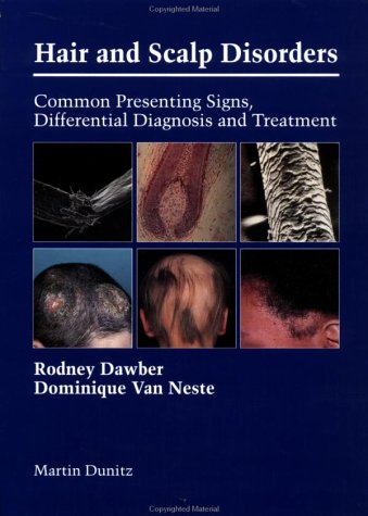 Stock image for Hair and Scalp Disorders: Common Presenting Signs, Differential Diagnosis and Treatment Dawber, R. P. R. and Van Neste, Dominique for sale by online-buch-de