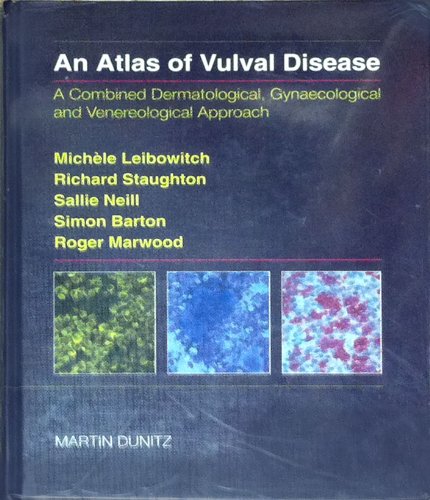 An Atlas Of Vulval Disease (9781853171277) by Leibowitch, Michele