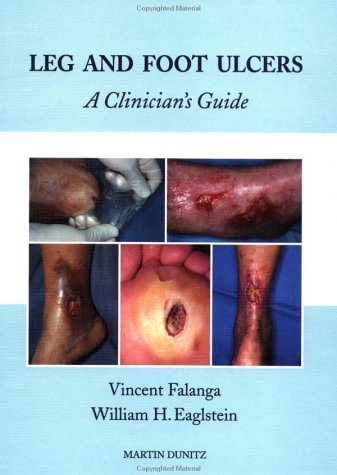 Beispielbild fr Leg and Foot Ulcers: A Clinician's Guide zum Verkauf von HPB-Red