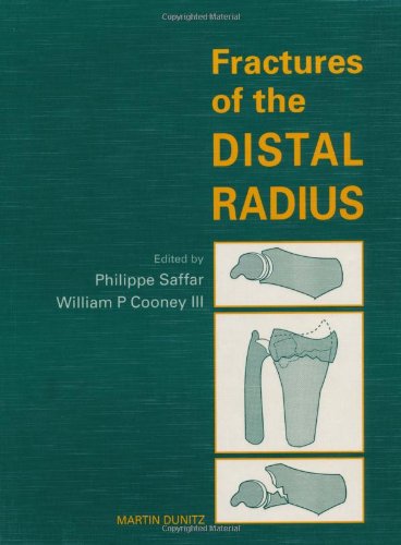 9781853171789: Fractures of the Distal Radius