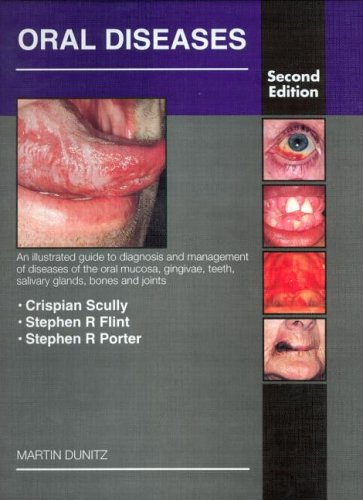 Oral Diseases: An Illustrated Guide to the Diagnosis and Management of Diseases of the Oral Mucosa, Gingivae, Teeth, Salivary Glands, Bones (9781853172021) by Flint, Stephen R; Porter, Stephen R; Scully, Crispian