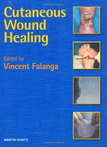 Imagen de archivo de Cutaneous Wound Healing a la venta por BooksRun