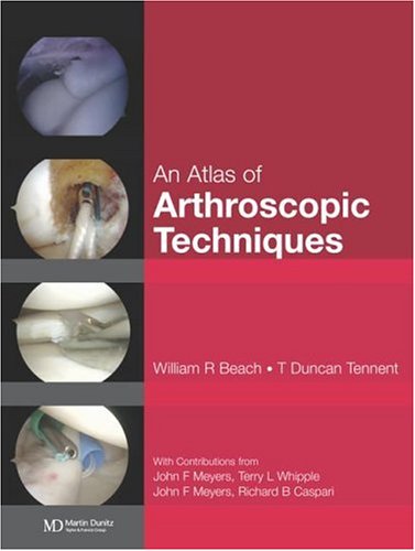 Beispielbild fr Atlas of Arthroscopic Techniques zum Verkauf von Buchpark