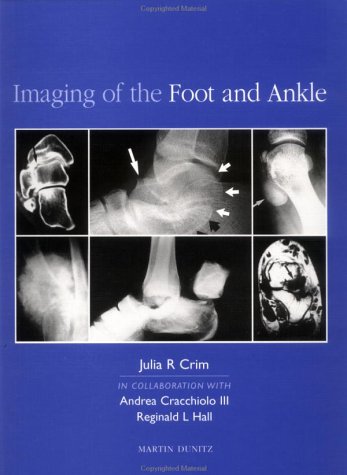 Stock image for IMAGING OF THE FOOT AND ANKLE for sale by Stephen Dadd
