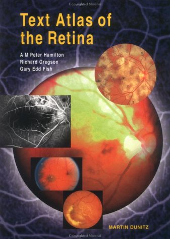 Text Atlas of the Retina (9781853172267) by Fish, Gary Edd; Gregson, Richard; Hamilton, A M Peter