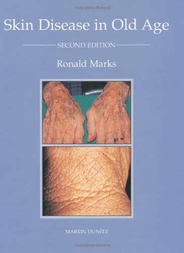 Beispielbild fr Skin Disease in Old Age zum Verkauf von Better World Books