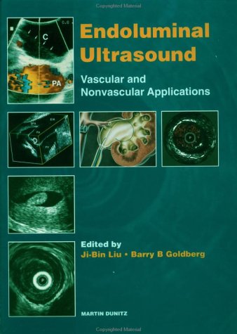 Endoluminal Ultrasound Vascular & Nonvascular Applications - Goldberg ...
