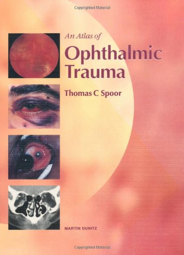 Atlas Of Ophthalmic Trauma