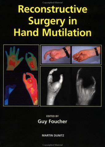 9781853173011: Reconstructive Surgery in Hand Mutilation