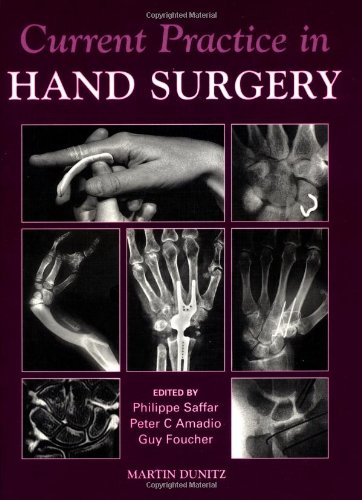 Beispielbild fr Current Practice In Hand Surgery zum Verkauf von ThriftBooks-Dallas