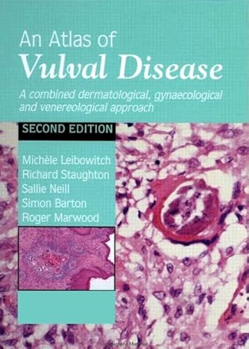 An Atlas of Vulval Diseases: A Combined Dermatological, Gynaecological and Venereological Approach (9781853174315) by Leibowitch, MichÃ¨le; Staughton, Richard; Neill, Sallie; Barton, Simon; Marwood, Roger