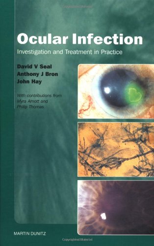 Beispielbild fr Ocular Infection: Management and Treatment in Practice zum Verkauf von WorldofBooks