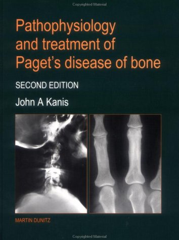 9781853174636: Pathophysiology and Treatment of Paget's Disease of Bone