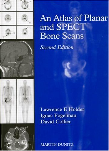 9781853174698: An Atlas of Planar and SPECT Bone Scans