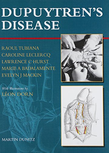 Dupuytren's Disease (9781853174759) by Badalmente, Marie A; Hurst, Lawrence C; Leclercq, Caroline; Mackin, Evelyn; Tubiana, Raoul; Hurst, Lawrence C.