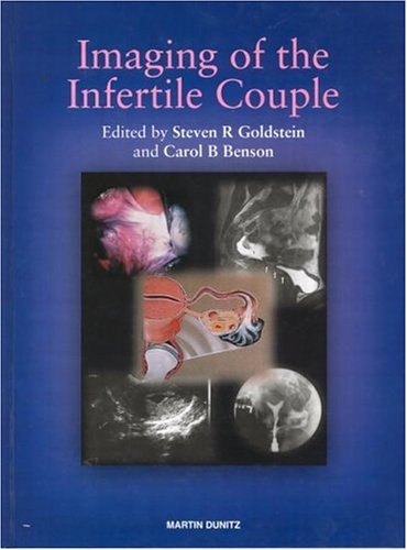 Beispielbild fr Imaging of the Infertile Couple zum Verkauf von Zubal-Books, Since 1961