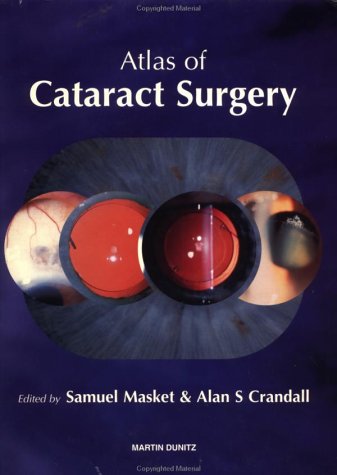 Imagen de archivo de Atlas of Cataract Surgery a la venta por Rob the Book Man