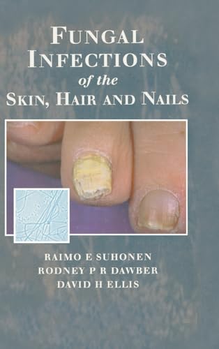 9781853175893: Fungal Infections of the Skin and Nails