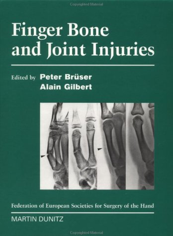 Finger Bone and Joint Injuries (9781853176906) by BrÃ¼ser, Peter; Gilbert, Alain