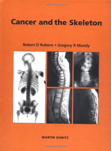 Beispielbild fr Cancer and the Skeleton zum Verkauf von BookMarx Bookstore
