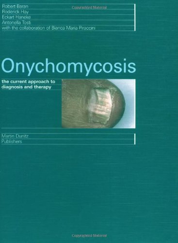 Imagen de archivo de Onychomycosis: The Current Approach to Diagnosis and Therapy a la venta por Half Price Books Inc.