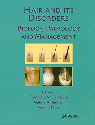 Stock image for Hair and Its Disorders: Biology, Pathology and Management: Research, Pathology and Management for sale by Chiron Media