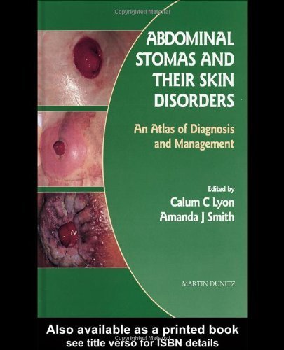 9781853178962: Abdominal Stomas and Their Skin Disorders: An Atlas of Diagnosis and Management