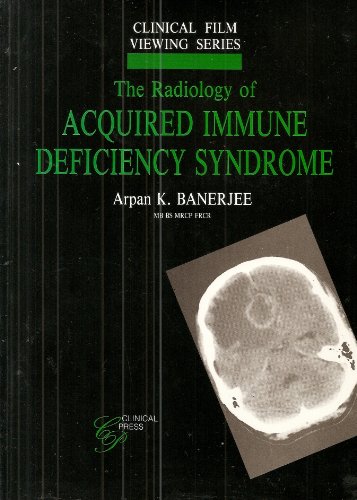 Stock image for The Radiology of Acquired Immune Deficiency Syndrome for sale by Blackwell's
