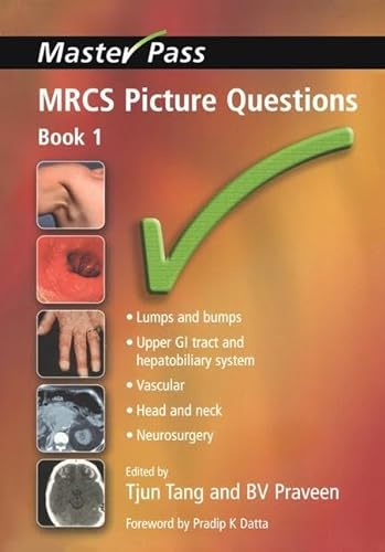 9781857757491: MRCS Picture Questions: Bk. 1 (MasterPass)
