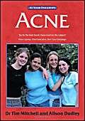 Immagine dell'editore per Acne : The at Your Fingertips Guide venduto da Better World Books Ltd