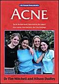 Stock image for Acne: The at Your Fingertips Guide for sale by Harry Righton