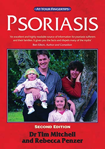 Beispielbild fr Psoriasis: The At Your Fingertips Guide zum Verkauf von Goldstone Books