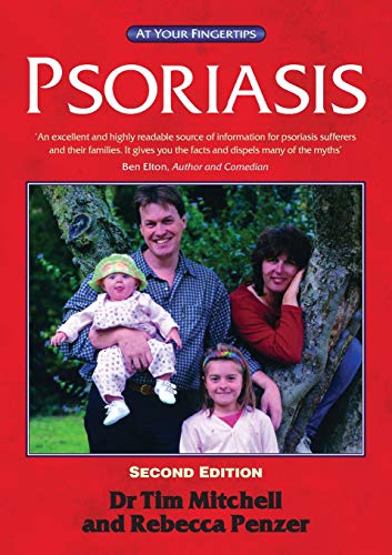 9781859591178: Psoriasis 2e: At Your Fingertips