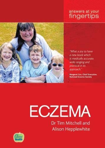 Stock image for Eczema for sale by Bestsellersuk