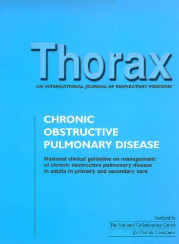 Beispielbild fr Chronic Obstructive Pulmonary Disease zum Verkauf von Anybook.com