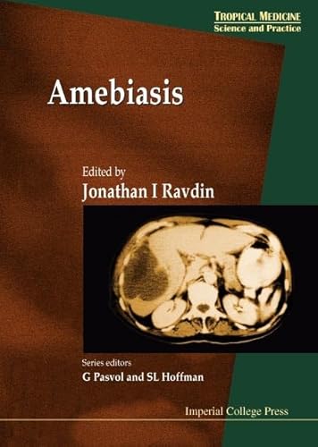 9781860941337: Amebiasis: 2 (Tropical Medicine: Science And Practice)