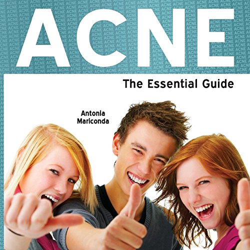 Beispielbild fr Acne - The Essential Guide (Need2know) zum Verkauf von WorldofBooks