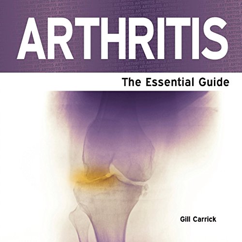 Beispielbild fr Arthritis: The Essential Guide zum Verkauf von WorldofBooks