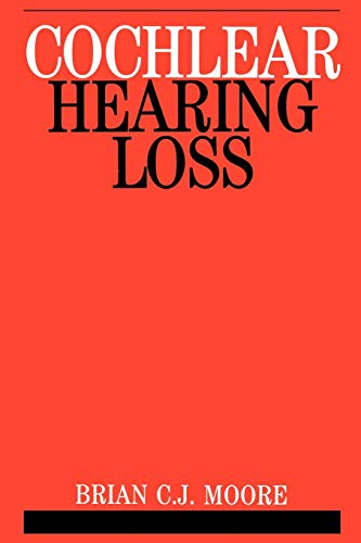 9781861560919: Cochlear Hearing Loss