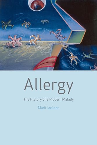 9781861892713: Allergy: The History of a Modern Malady
