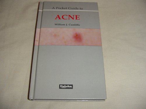 9781870026505: A Pocket Guide to Acne