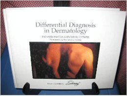 Beispielbild fr Differential Diagnosis in Dermatology, Second Edition zum Verkauf von SecondSale