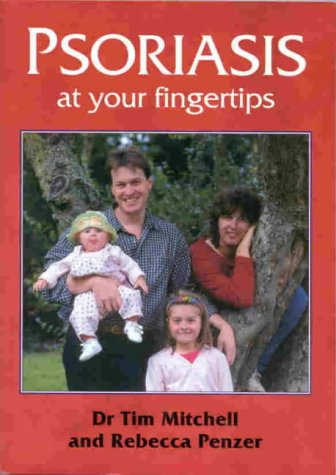 Beispielbild fr Psoriasis at Your Fingertips : The Comprehensive and Medically Accurate Manual on Managing Psoriasis zum Verkauf von Better World Books Ltd