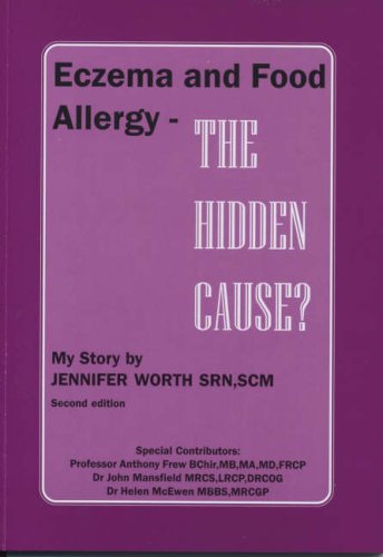 9781872560182: Eczema and Food Allergy - The Hidden Cause?: My Story