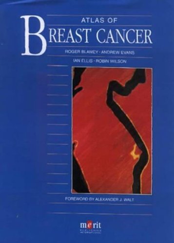 9781873413708: Atlas on Breast Cancer