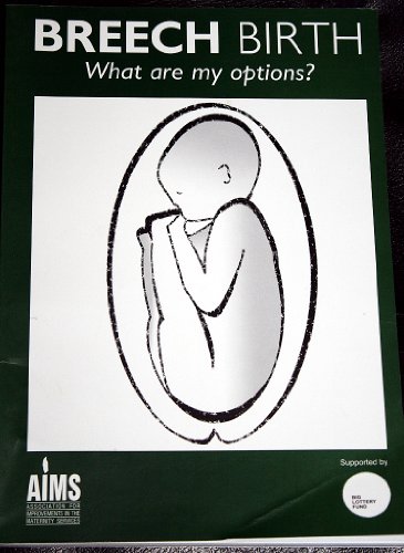 Beispielbild fr Breech Birth: What are My Options? zum Verkauf von WorldofBooks