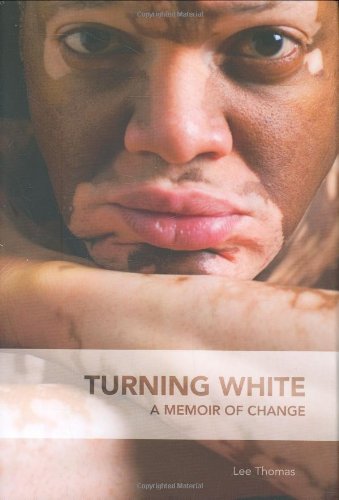 Stock image for Turning White: A Memoir of Change for sale by ThriftBooks-Atlanta