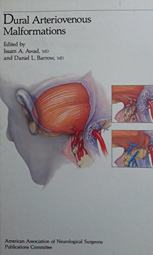 Dural Arteriovenous Malformation (Special topics series)