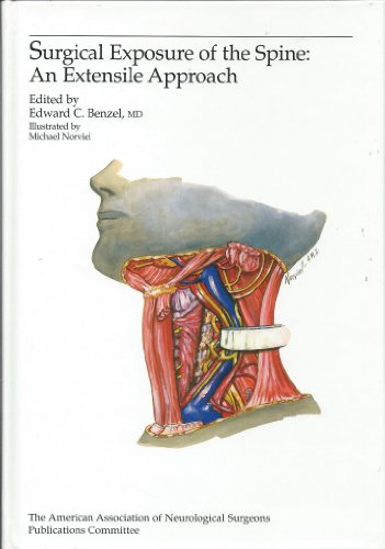 Imagen de archivo de Surgical Exposure of the Spine: An Extensile Approach a la venta por Cape Breton Regional Library